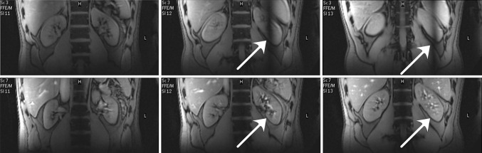 Fig. 16