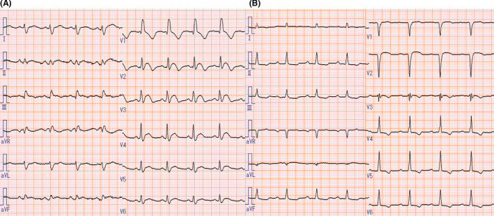 FIGURE 1