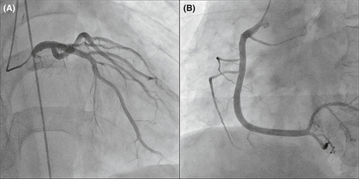 FIGURE 3