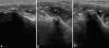 Fig. 4A–C