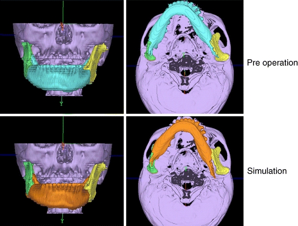 Fig. 2