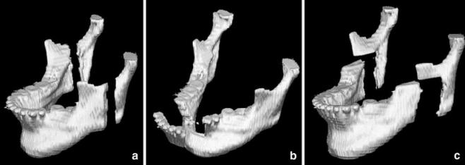 Fig. 3