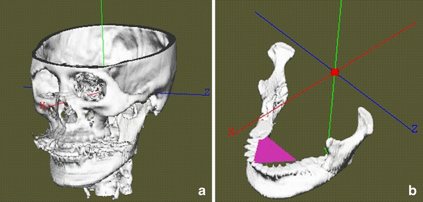 Fig. 1