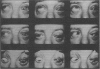 112