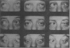 113