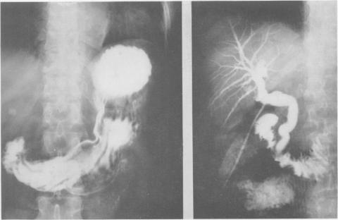 Fig. 1., Fig. 2.