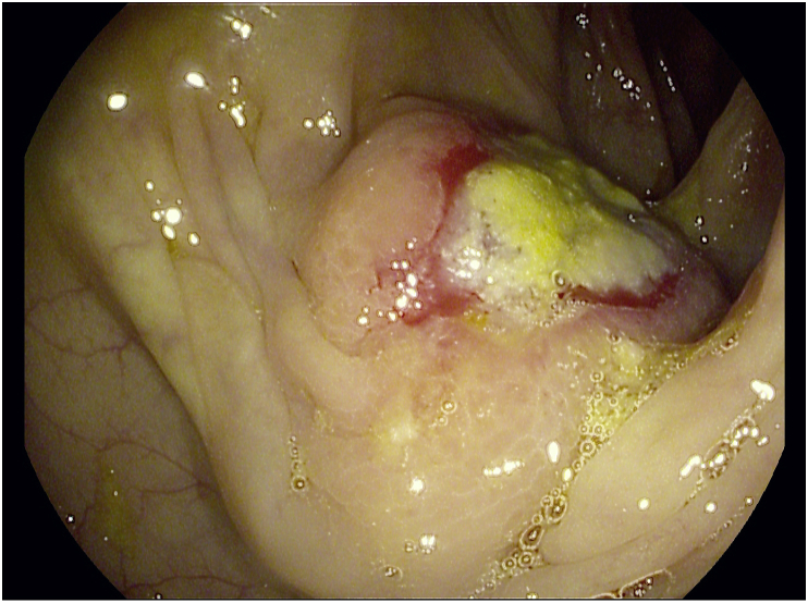 Fig. 2
