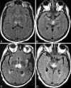 Fig 3.
