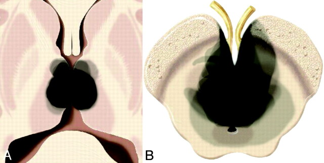 Fig 2.