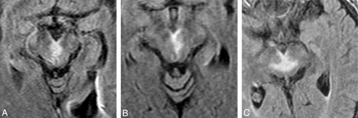 Fig 5.