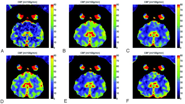 Fig 3.