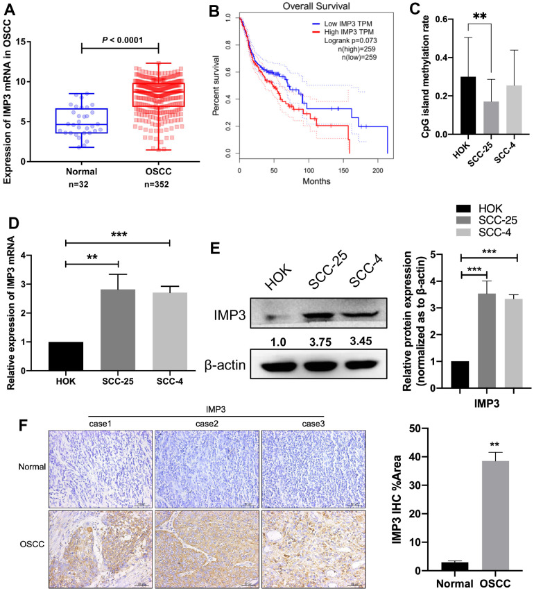 Knockdown Of Rna-binding Protein Imp3 Suppresses Oral Squamous Cell 