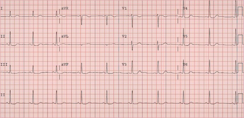 Figure 1