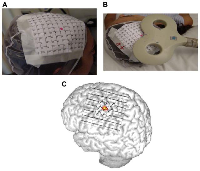 Fig. 11