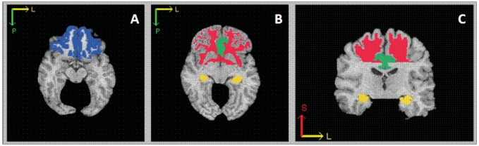 Fig. 1