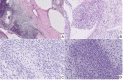 Fig. 11