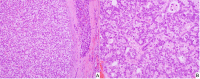 Fig. 15
