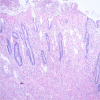 Fig. 13