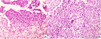 Fig. 14