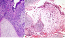 Fig. 16