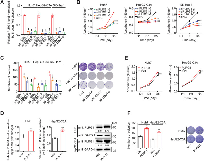 Figure 5. PLRG1 promotes HCC cell proliferation. A, qRT-PCR analysis of PLRG1 knockdown efficiency after transfection of Huh7, HepG2-C3A, and SK-Hep1 cells with three independent PLRG1 siRNAs. B, CCK-8 assays in the Huh7, HepG2-C3A, and SK-Hep1 cells transfected with three independent PLRG1 siRNAs. C, Colony formation assays and colony counts in the Huh7, HepG2-C3A, and SK-Hep1 cells transfected with three independent PLRG1 siRNAs. D, qRT-PCR and WB analysis of PLRG1 overexpression efficiency in stable pCDH-PLRG1 Huh7 and HepG2-C3A cells. E, CCK-8 assays in stable PLRG1-overexpressing and control Huh7 and HepG2-C3A cells. F, Colony formation assays and colony counts in stable PLRG1-overexpressing and control Huh7 and HepG2-C3A cells. The values are expressed as the mean ± SEM (A–F, n = 3). ****, P < 0.0001; ***, P < 0.001; and **, P < 0.01 by one-way ANOVA or two-sided Student t test.