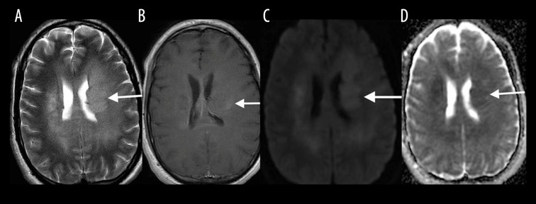 Figure 15