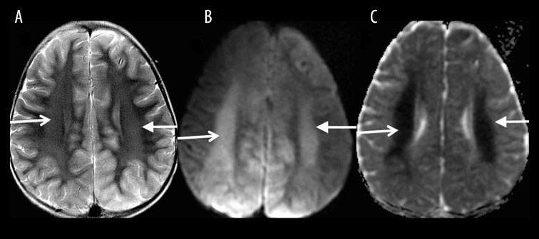 Figure 16