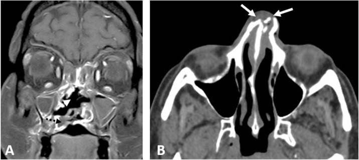 Fig. 5