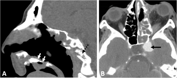 Fig. 4