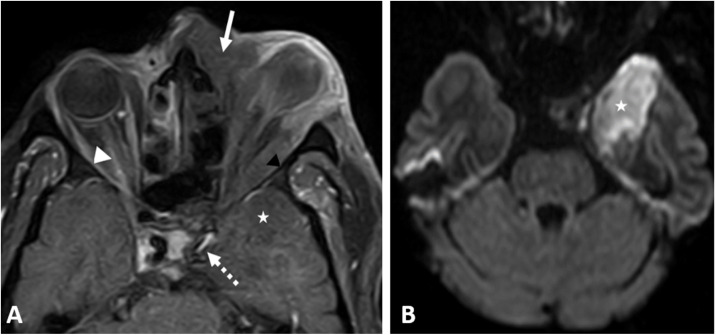 Fig. 6