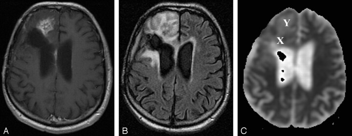 Fig 3.