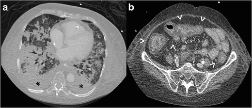 Fig.
15