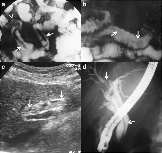 Fig. 14