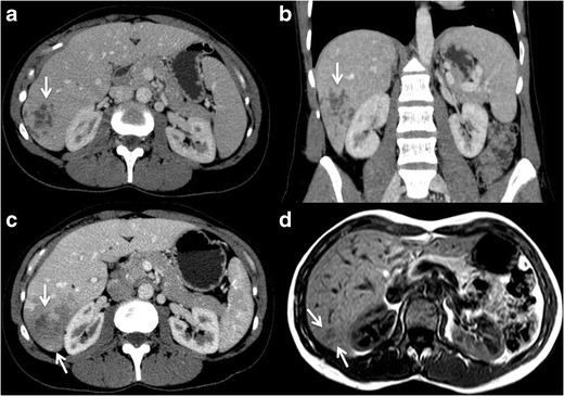 Fig.
13
