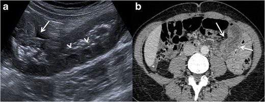 Fig.
17