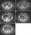 Fig. 1