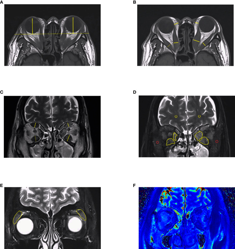 Figure 3