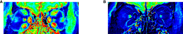 Figure 4