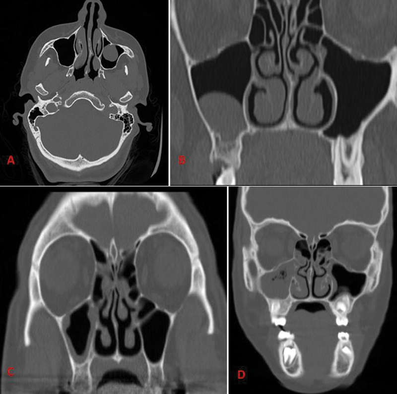 Fig. 5