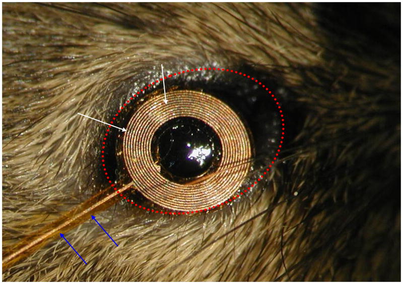 Fig. 1