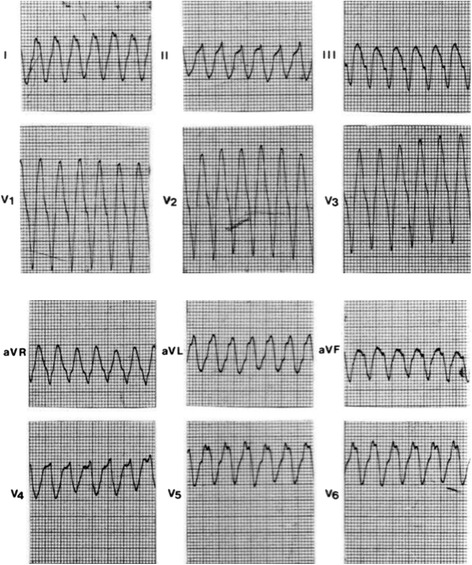 Fig. 9