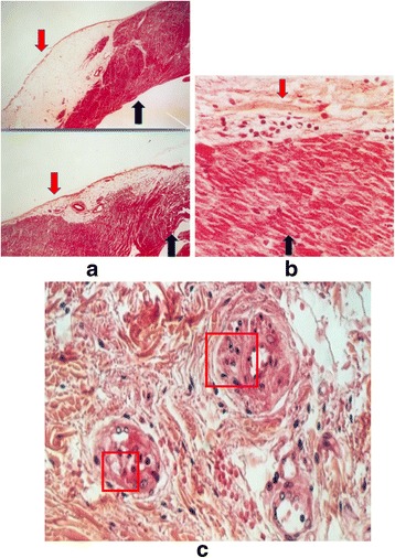 Fig. 11