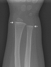 Fig. 9