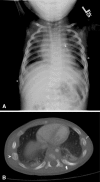 Fig. 2A–B
