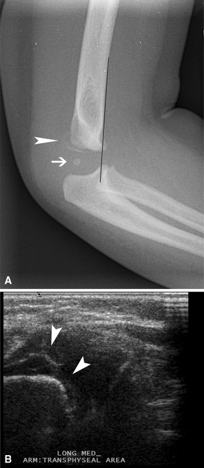 Fig. 7A–B