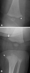 Fig. 10A–B