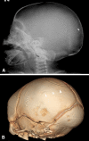 Fig. 13A–B