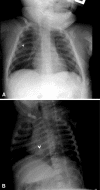 Fig. 1A–B