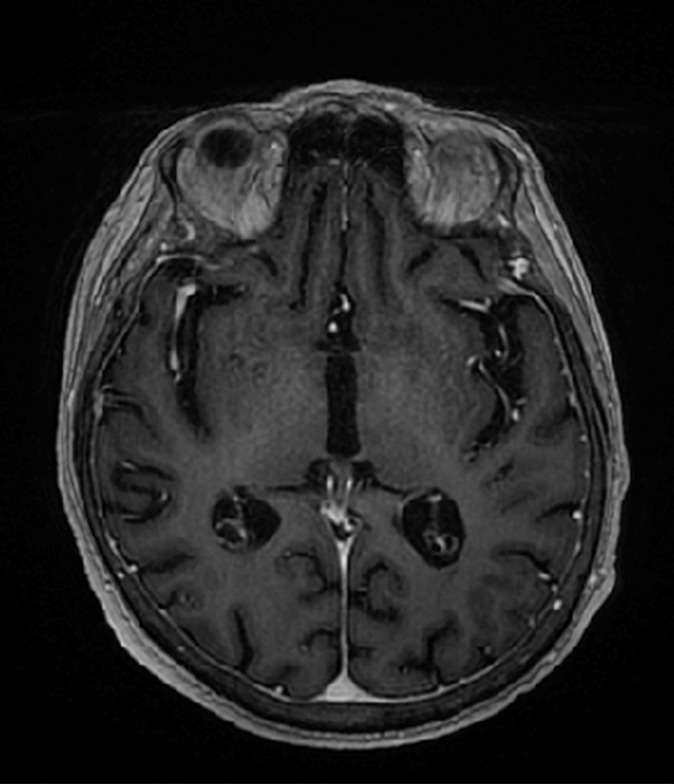 Figure 2a: