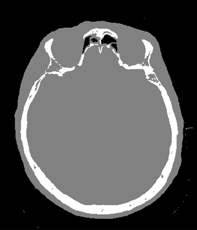 Figure 2c: